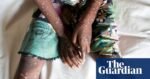 Warnings over lethal and contagious strain of mpox as children in DRC die | Global health