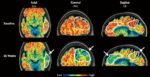 Boston scientists create AI model to ‘catch Alzheimer’s disease early’