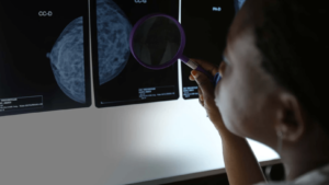Health And Finance Leaders Call For Strengthened Primary Health Care To Tackle NCDs And Mental Health