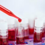 Experts call for more clinical trials on alcohol use, liver disease: Newsroom