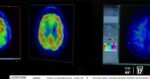 Why brain health should take a front seat for women