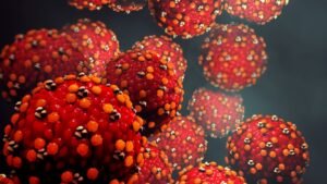 Measles cases surge to over triple last year with five months still to go Measles cases surge to over triple last year with five months still to go