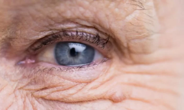 Oral antioxidants may delay geographic atrophy in AMD patients, finds study
