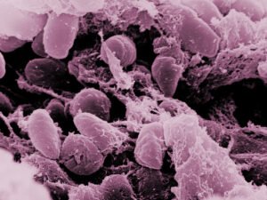 Health officials confirm case of human plague in Pueblo County