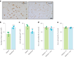 Opioid-induced neuroanatomical, microglial and behavioral changes are blocked by suvorexant without diminishing opioid analgesia