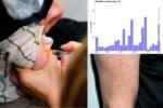 Measles cases in US triple last year’s total — NYC saw 11 cases in 2024