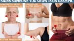 the tell-tale signs someone you know is on Ozempic… and how to avoid them if you are