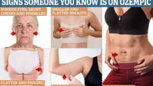 the tell-tale signs someone you know is on Ozempic… and how to avoid them if you are