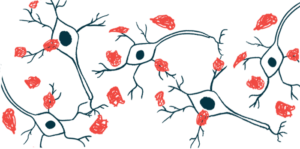 Alpha-synuclein process may be therapeutic target in Parkinson’s