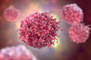 Scientists Discover Potential Biomarker in Rare Skin Cancer