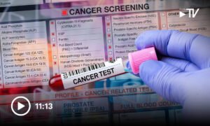 AI-for-Oncology Copilots Detect, Treat Cancer Earlier