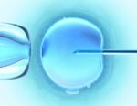 Study finds flurbiprofen ester effective for pain relief during transvaginal 4D hysterosalpingography
