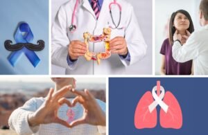 More than 125K deaths expected this year for one of the most common cancers on Staten Island