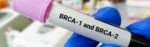 Lower risk of developing breast cancer for some ovarian cancer survivors