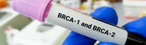 Lower risk of developing breast cancer for some ovarian cancer survivors