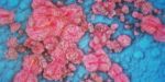 11 cases of mpox so far this year in CT