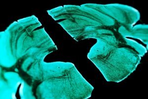 We may now know how the placebo effect relieves pain