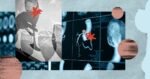 What does alcohol consumption actually do to the heart?