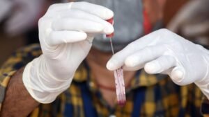 4-year-old boy in Gujarat’s Bharuch dies of suspected Chandipura virus 
