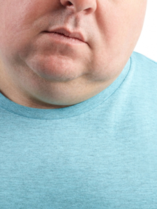 Easy Tips To Reduce Your Double Chin – News18