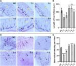 Cure for male pattern baldness given boost by sugar discovery