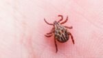 Tick-Borne Illnesses Are on the Rise in Canada