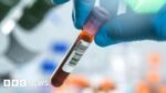 Woman needed HIV test after GP used old genital swab Woman needed HIV test after GP used old genital swab