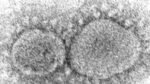 Increase in COVID cases in New York