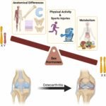 Females’ osteoarthritis risk should be addressed early in life, says study
