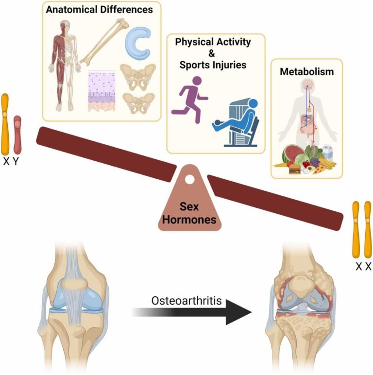 Females’ osteoarthritis risk should be addressed early in life, says study