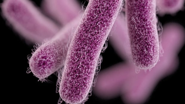 Shigella outbreak hits Calgary shelters and encampments, sending 16 to hospital