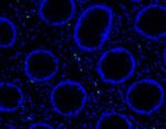 Long COVID uncharacteristic immune cell activity and SARS-CoV-2 RNA found in the gut two years after infection