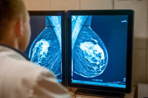 MHRA approves capivasertib for treatment of advanced breast cancer