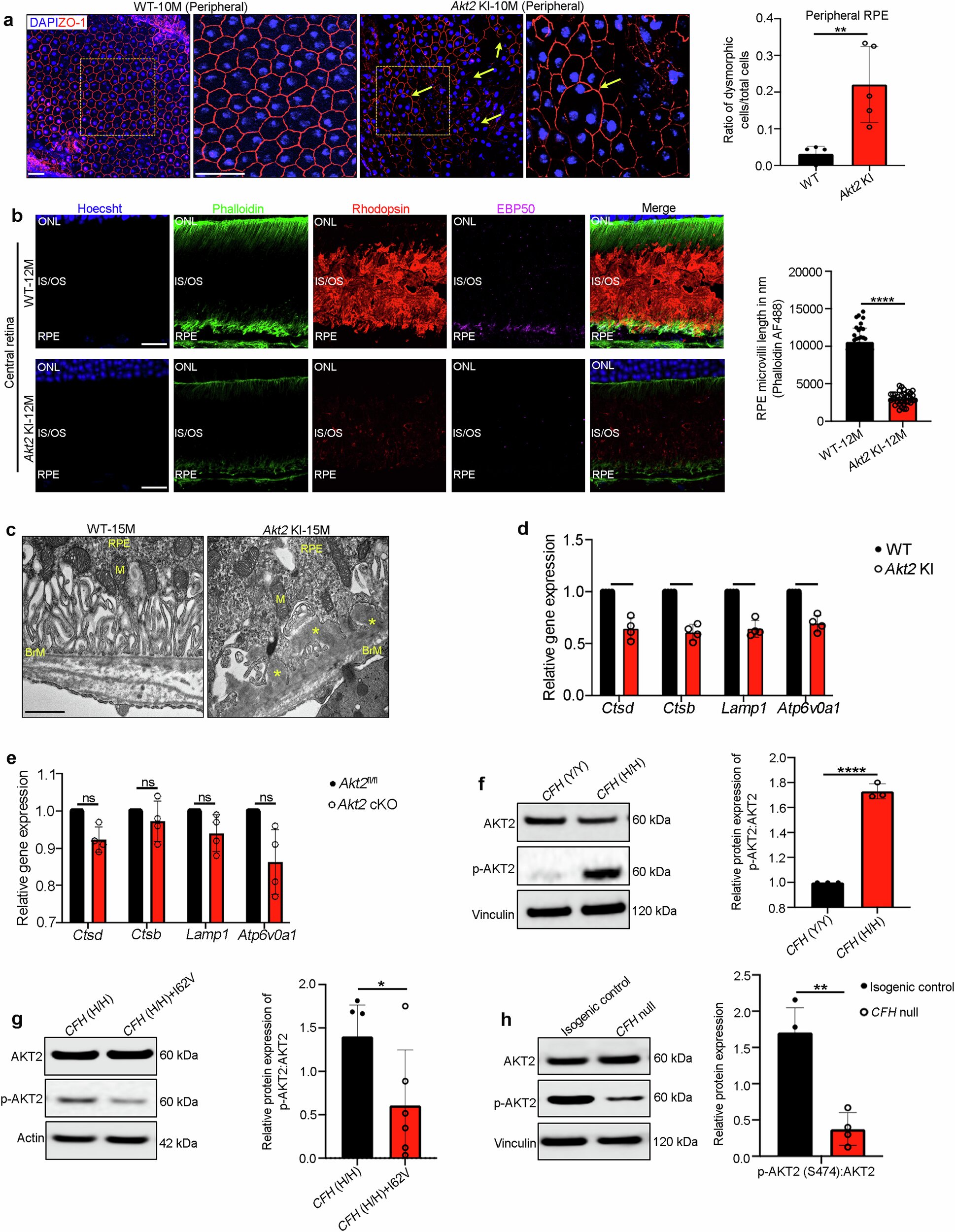 Researchers discover potential therapeutic target for degenerative eye disease