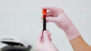 Platelets and Monocytes Communicate in Newly Discovered Immune Pathway