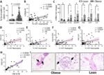 Study finds obese patients have more neutrophils than those who are not obese