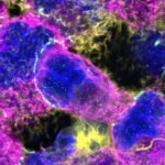 Study reveals ‘cell death cascade’ in airway cells infected with SARS-CoV-2