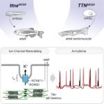Tiny deletion in heart muscle protein linked to long-term effects on adult atrial fibrillation