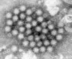 Four norovirus outbreaks detected in Sonoma County in past month