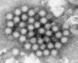 Four norovirus outbreaks detected in Sonoma County in past month