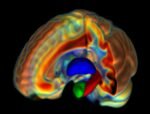 New study links brain microstructure to gender differences in mental health